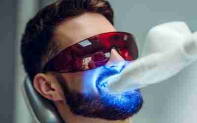 How Professional Teeth Whitening Can Transform Your Smile